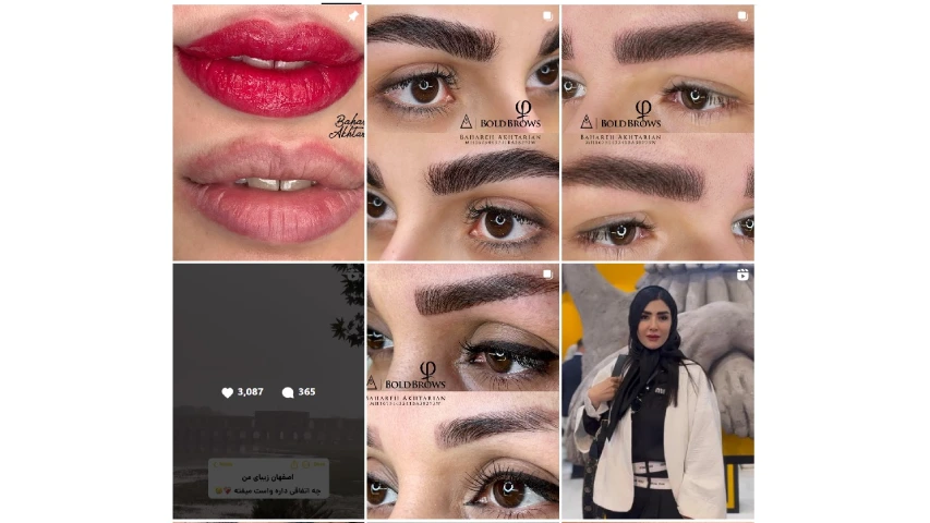 اختریان فیبروز ابرو