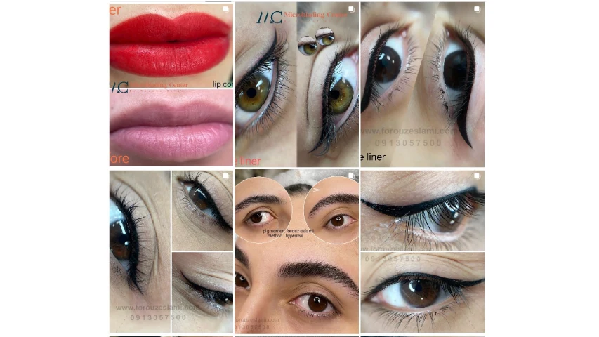 بهترین فیبروز ابرو اصفهان اسلامی