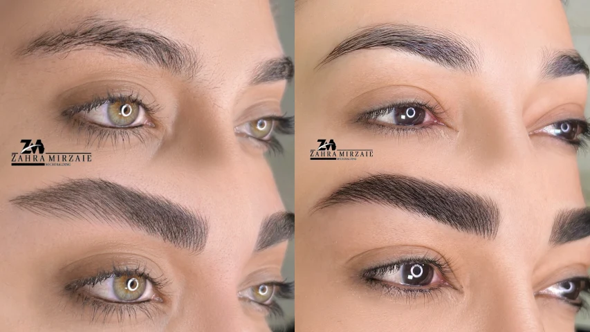 بهترین فیبروز ابرو در اصفهان