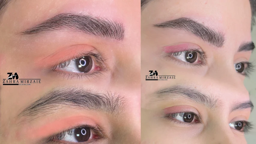 زهرا میرزایی فیبروز ابرو اصفهان