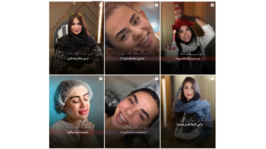 شروین فیبروز ابرو اصفهان