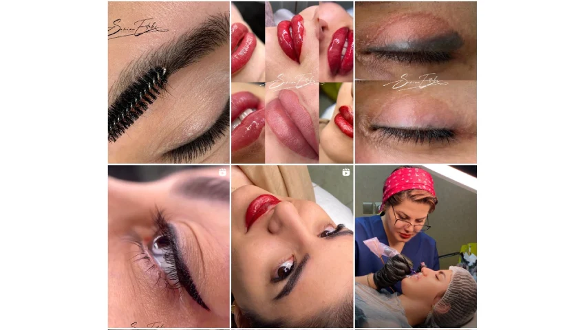 فیبروز ابرو اصفهان استکی