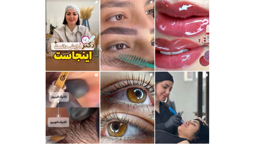 فیبروز ابرو اصفهان سمانه