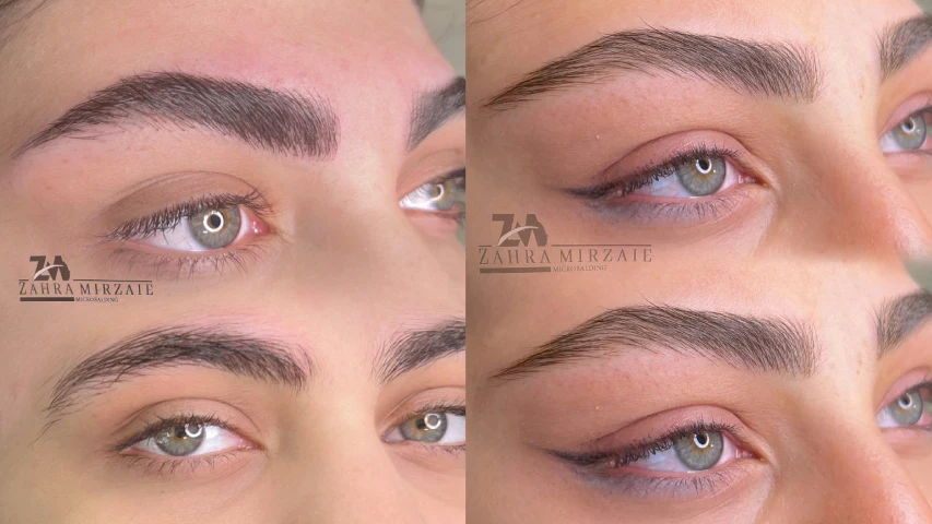 فیبروز ابرو در اصفهان