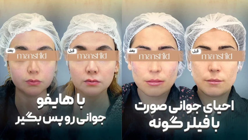 کلینیک زیبایی اصفهان مینا دادگر