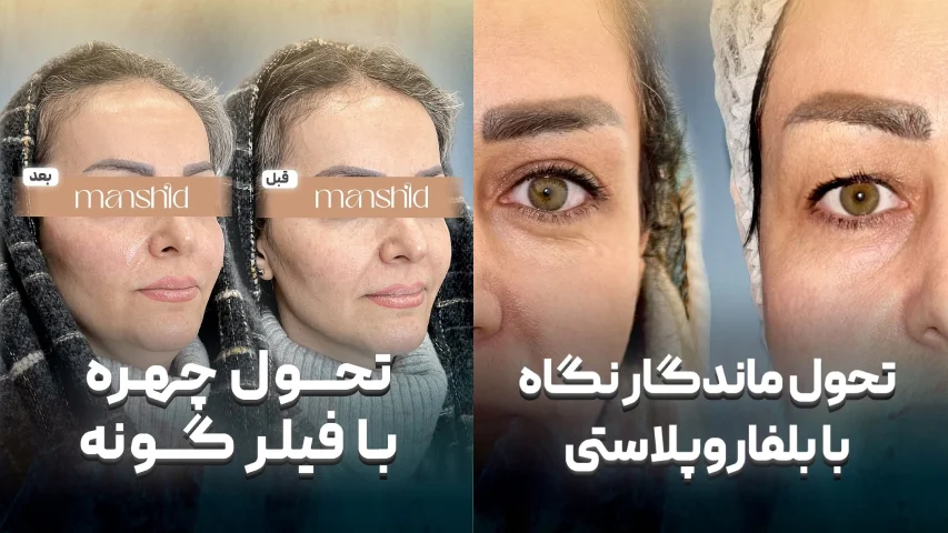 کلینیک زیبایی مانشید اصفهان