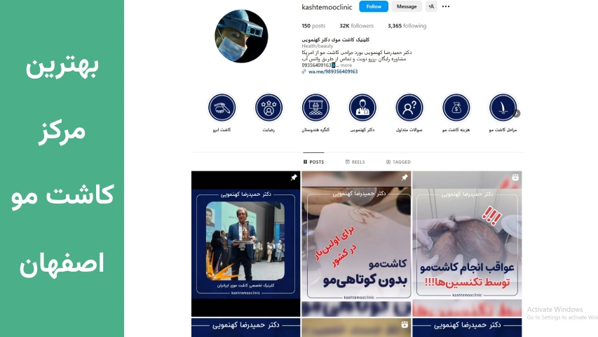 بهترین مرکز کاشت مو اصفهان