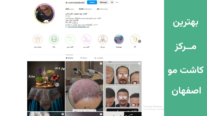 بهترین کلینیک های کاشت مو اصفهان