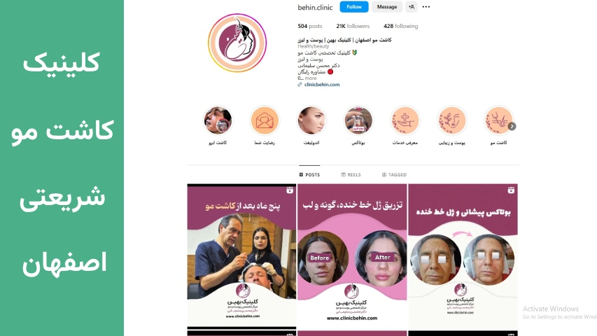 بهترین کلینیک کاشت مو شریعتی اصفهان