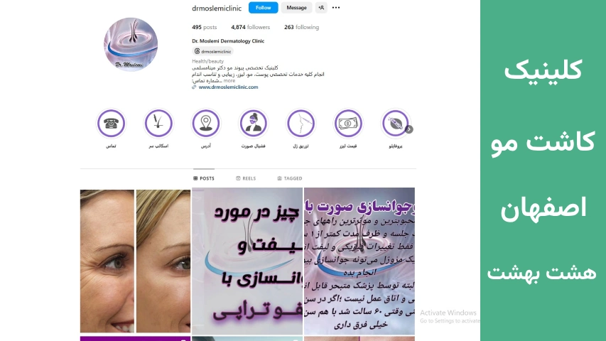 کلینیک کاشت مو اصفهان هشت بهشت