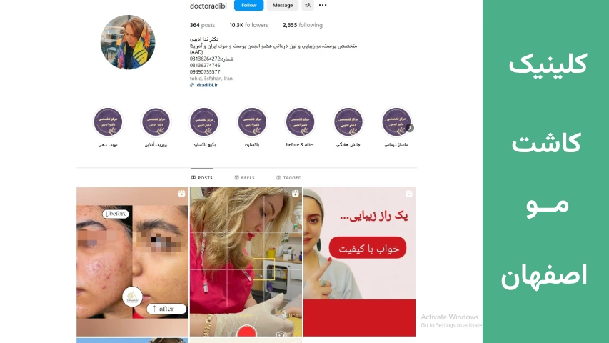 کلینیک کاشت مو اصفهان