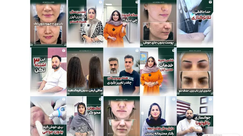 بهترین مرکز لیزر صورت در اصفهان