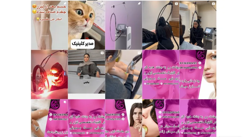 بهترین مرکز لیزر موی زائد اصفهان