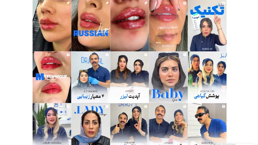 بهترین مرکز لیزر و زیبایی اصفهان