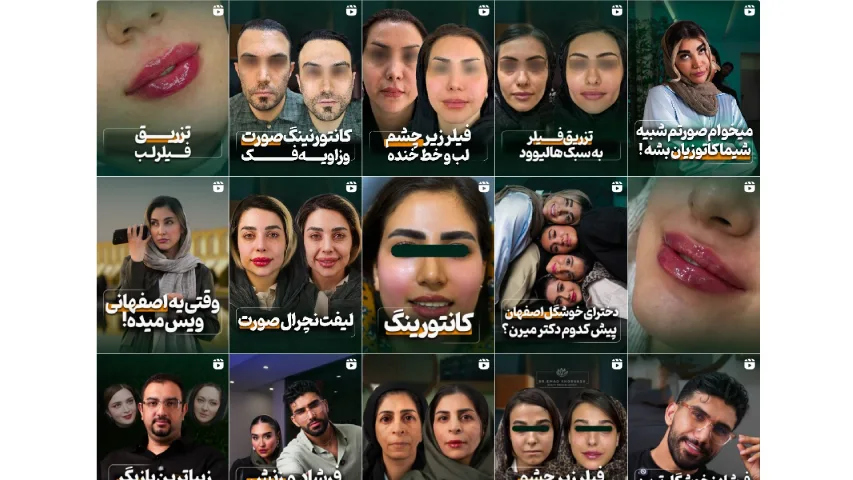 مرکز لیزر پوست اصفهان